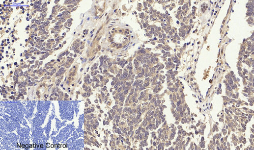 IHC - p38 Polyclonal Antibody AP71696